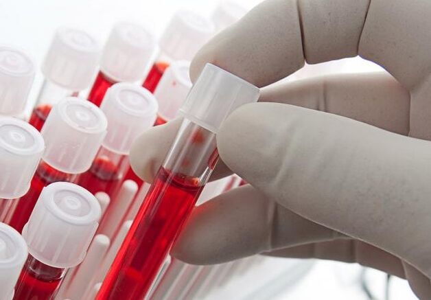 test de sânge după consumul de alcool